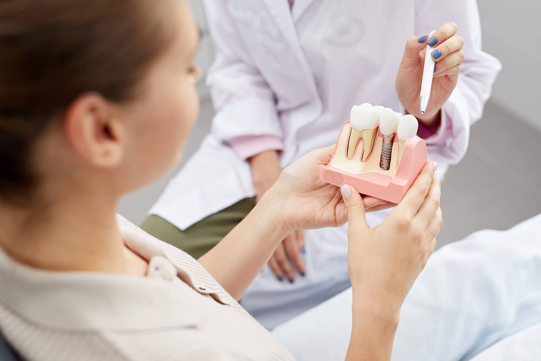 Understanding Dental Implants: A Lasting Solution for Missing Teeth at Alora Dental