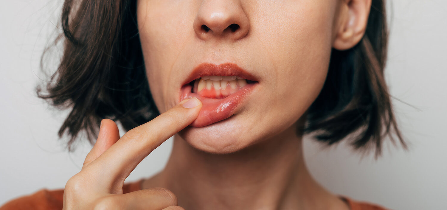 gum-disease-and-inflammation_1 The Dental Implant Process