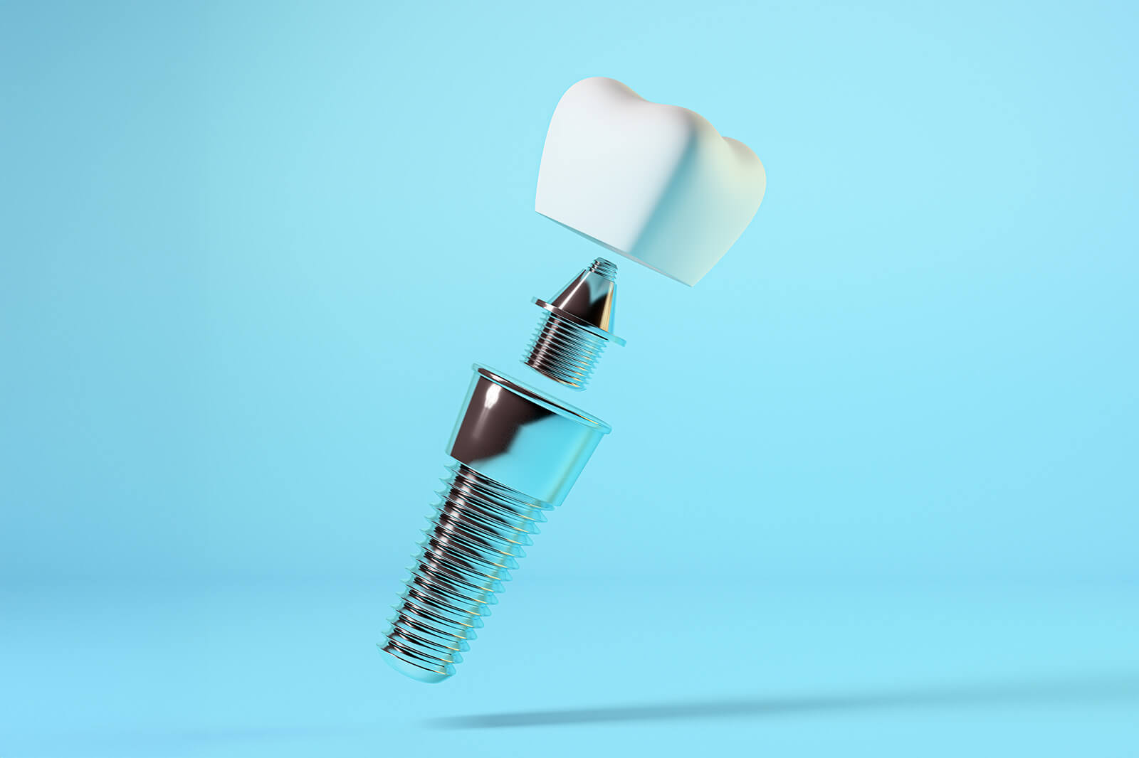 the-crown-the-visible-natural-looking-tooth_1 The Dental Implant Process