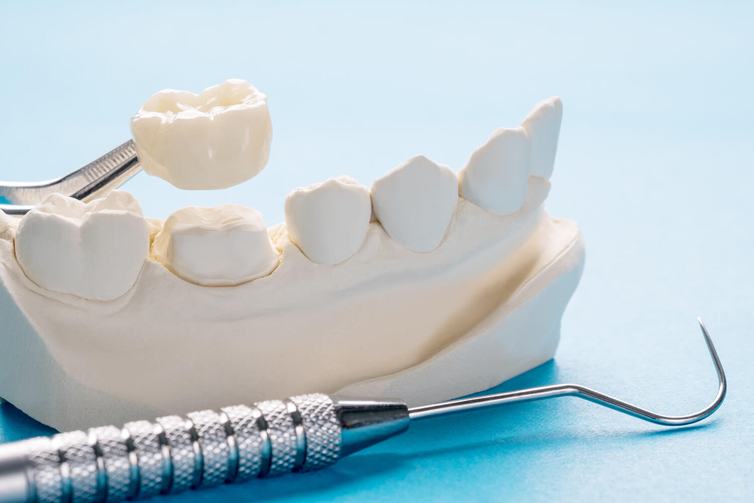 signs your dental crown may need replacement