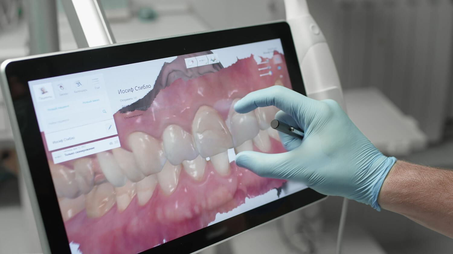 benefits of digital dental scanning