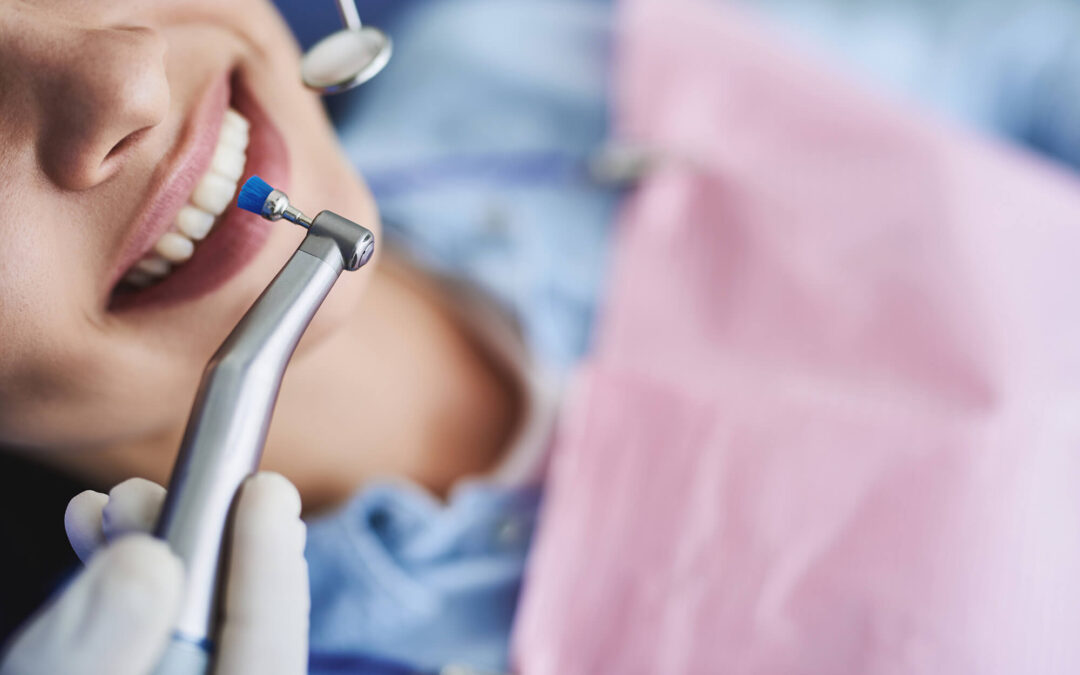 Why You Should Never Skip a Professional Dental Cleaning